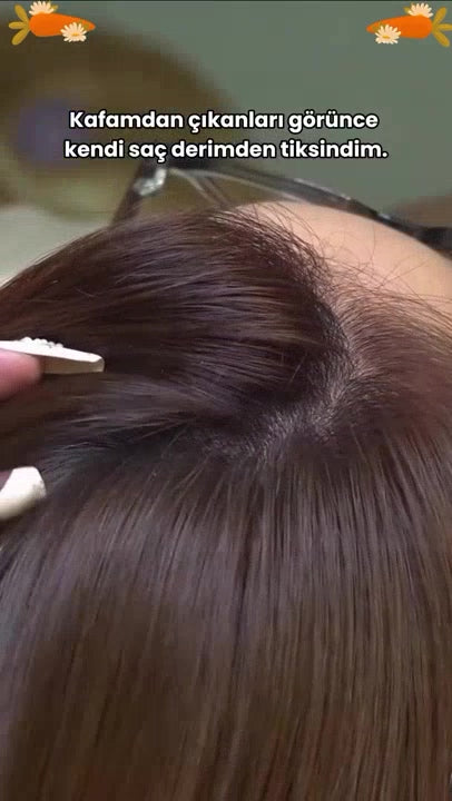 Dermascalp™ Kepek Tarağı